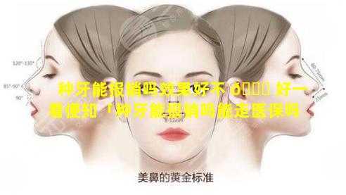 种牙能报销吗效果好不 🐛 好一看便知「种牙能报销吗能走医保吗」